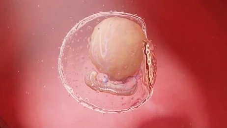 amniotic cell therapy near you