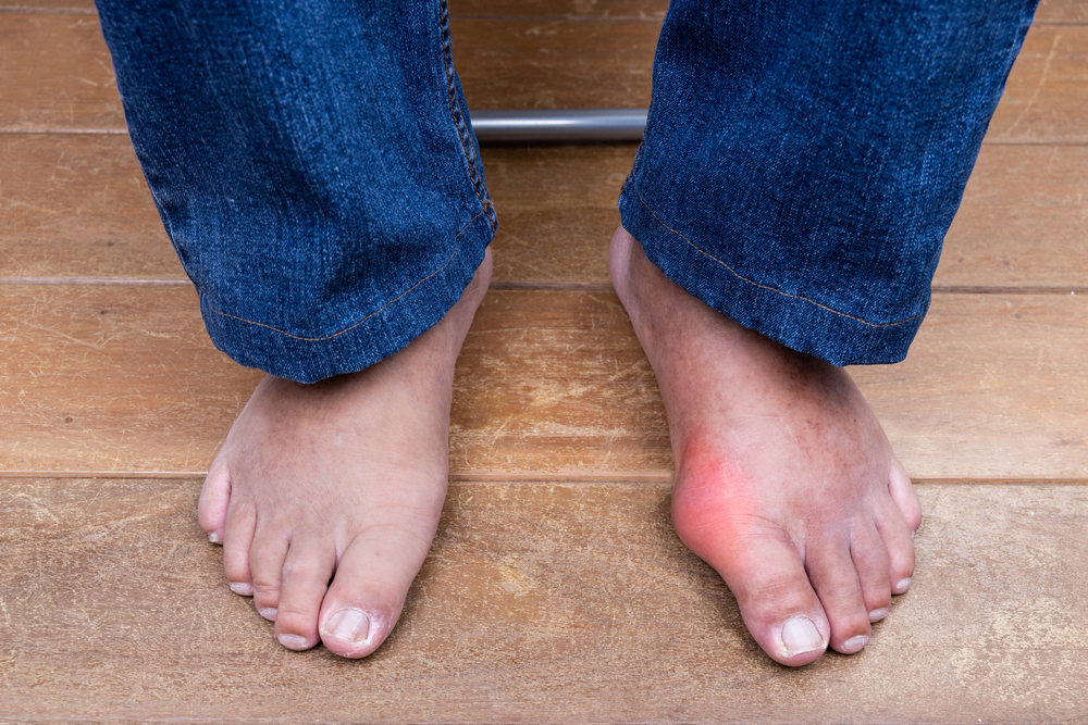 gout treatment near you